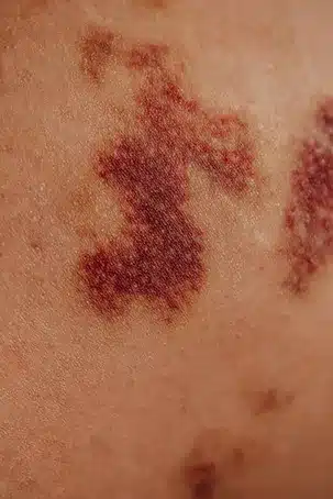 1. Reduce el dolor y la inflamación