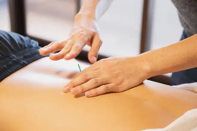 2. Integración de la acupuntura en la medicina occidental