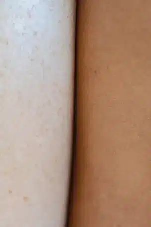 3. Acepta las diferencias: