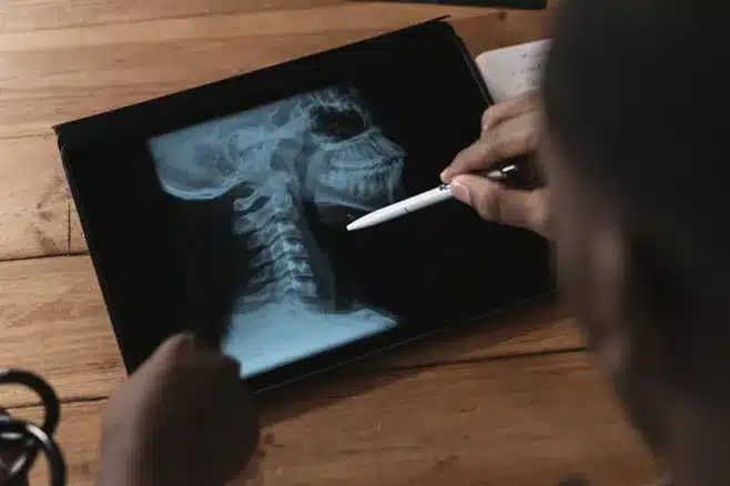 3. ¿Cuál es la función de los nervios espinales cervicales?