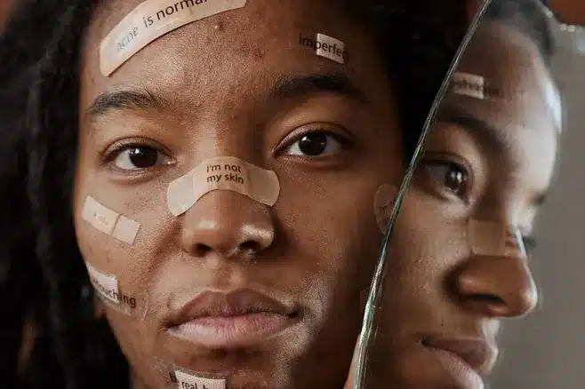 ¿Qué puedo hacer si tengo dificultades para aceptarme a mí mismo?