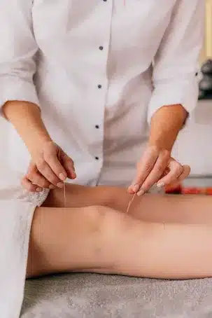 Aplicación en la práctica de la acupuntura