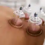 Guía completa: Puntos de acupuntura efectivos para tus tratamientos
