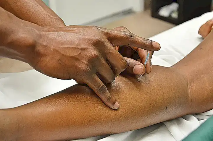 I. La acupuntura y su relevancia en la medicina actual