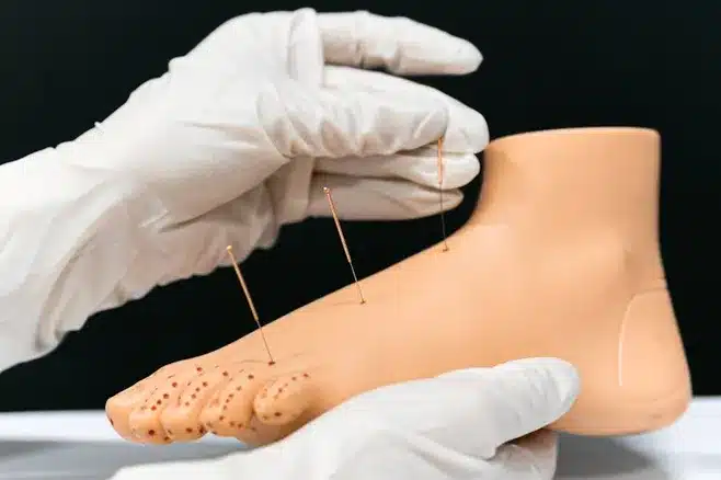 Institutos Para Estudiar Terapia Fisica