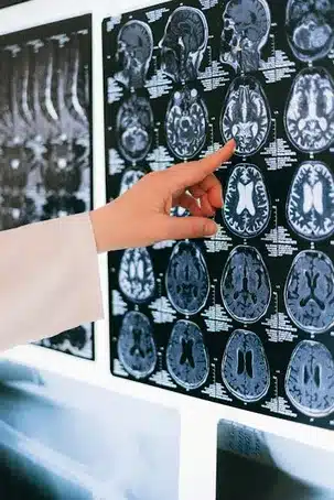 Investigación en neurociencia