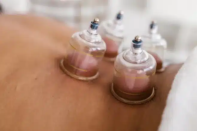 ¿La terapia biodinámica craneosacral es efectiva?