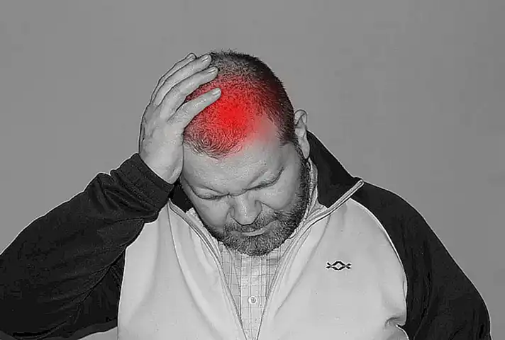 Puntos de acupuntura para el dolor de cabeza y migrañas