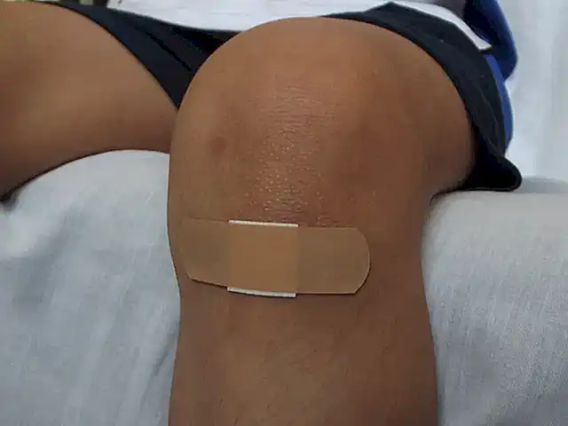 ¿Qué tipo de heridas se pueden tratar con la terapia larval?