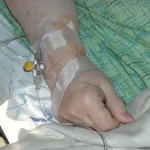 Terapia Endovenosa Pdf