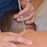 Terapia Neural con Procaina: Alivia tus dolores de forma natural