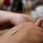 Todo sobre la acreditación y certificación de terapeutas de acupuntura