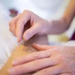 Tratamiento de salud con acupuntura en meridiano de la vesícula biliar